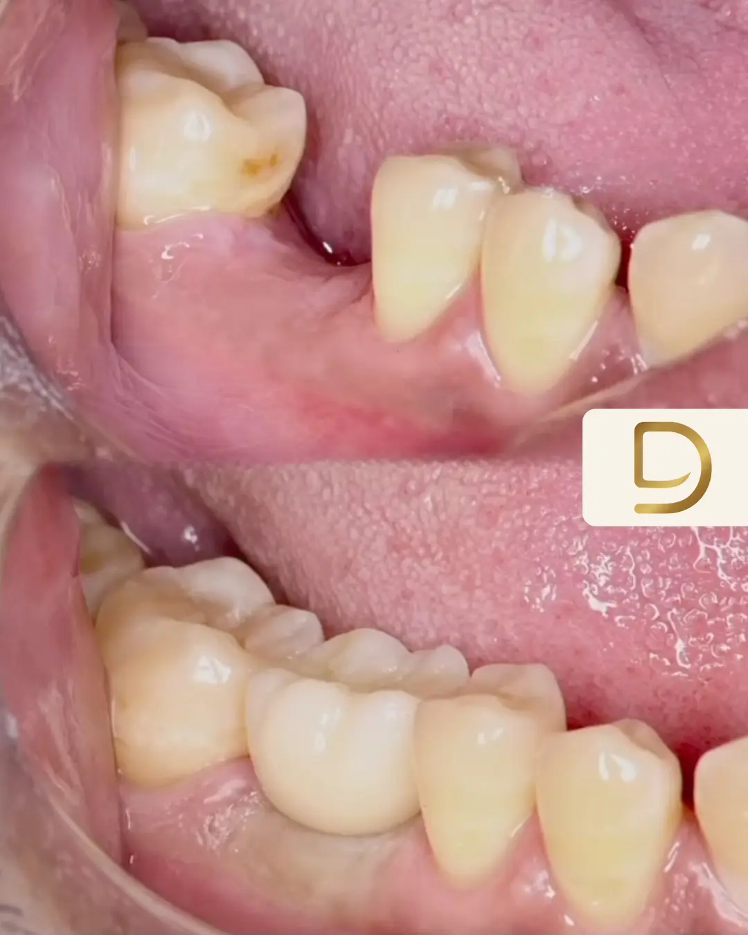 Lye Dental on Instagram
