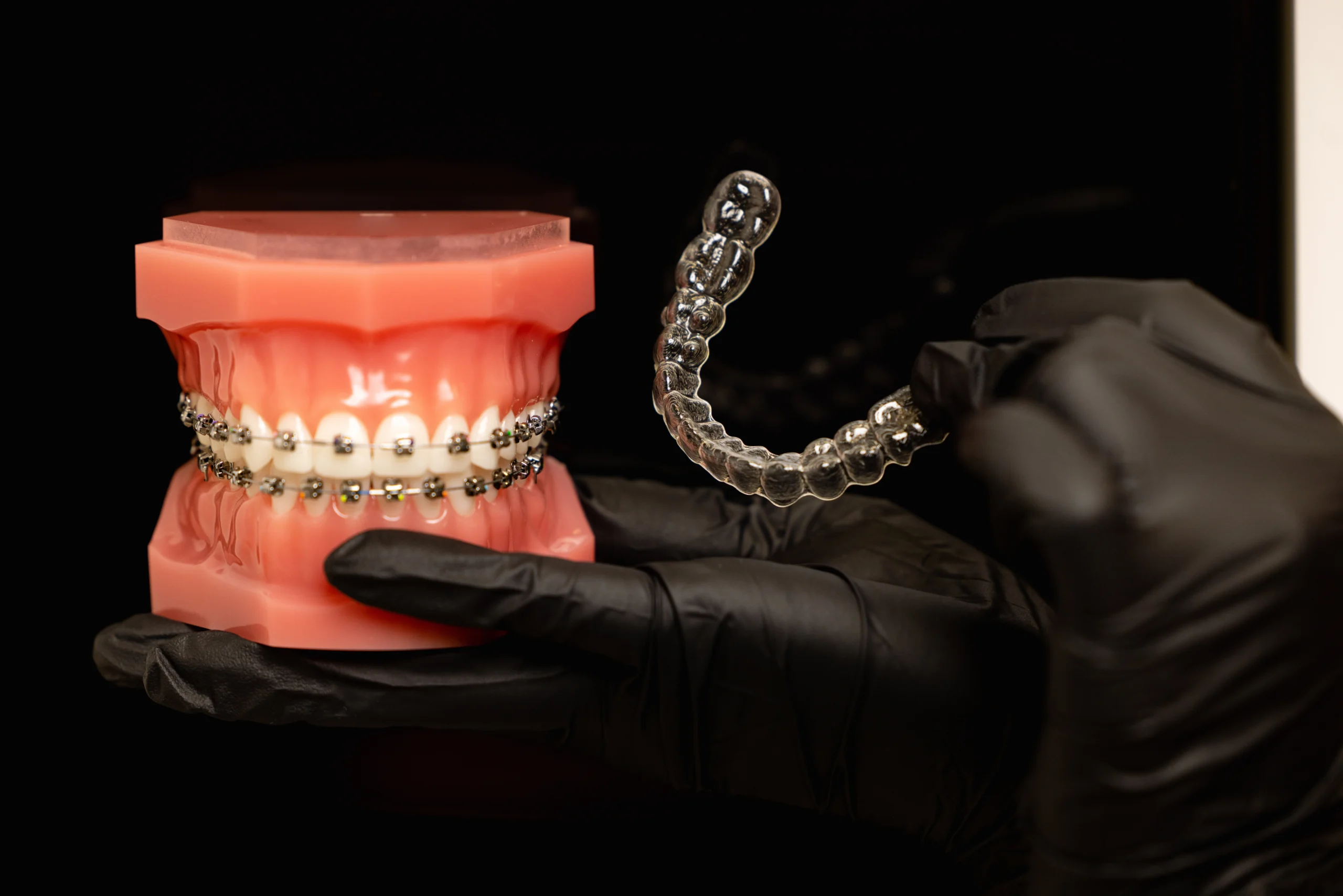 Invisalign clear aligner next to fixed metal braces