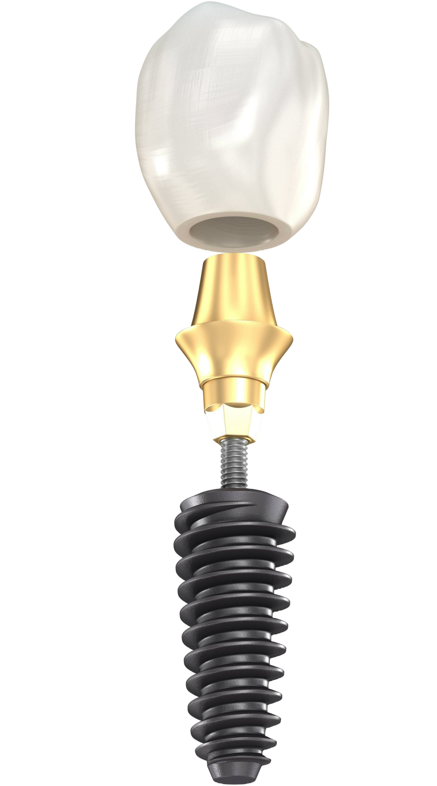 The parts of a dental implant: crown, abutment and titanium post
