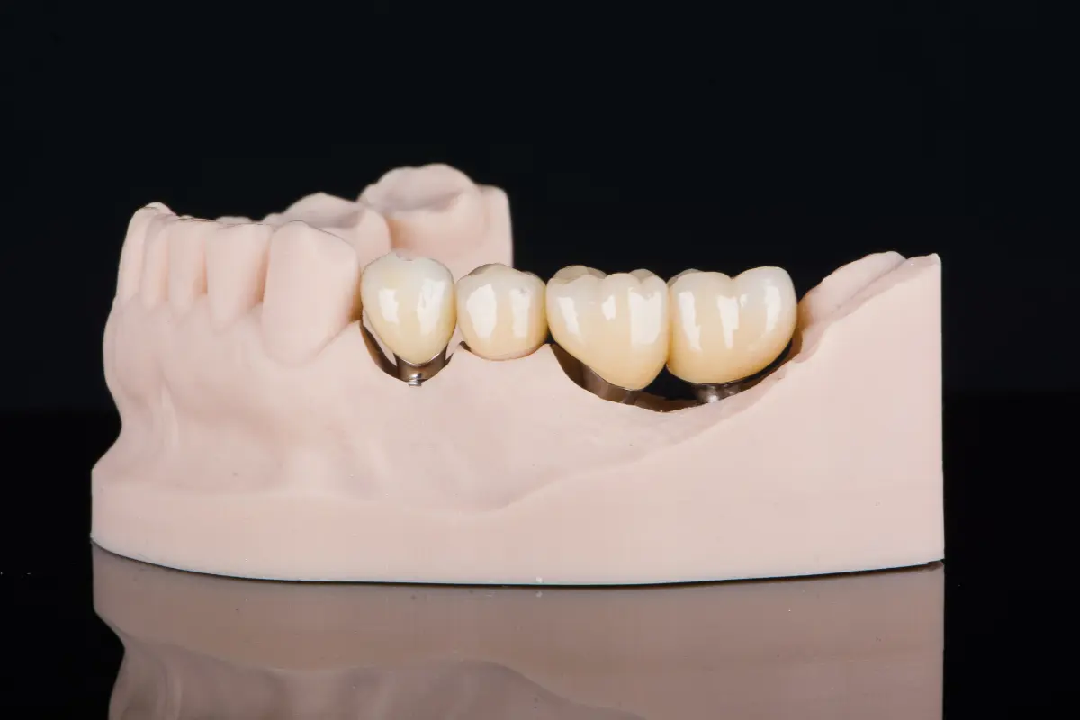 Several teeth