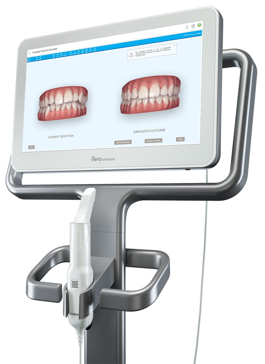 iTero digital scanner