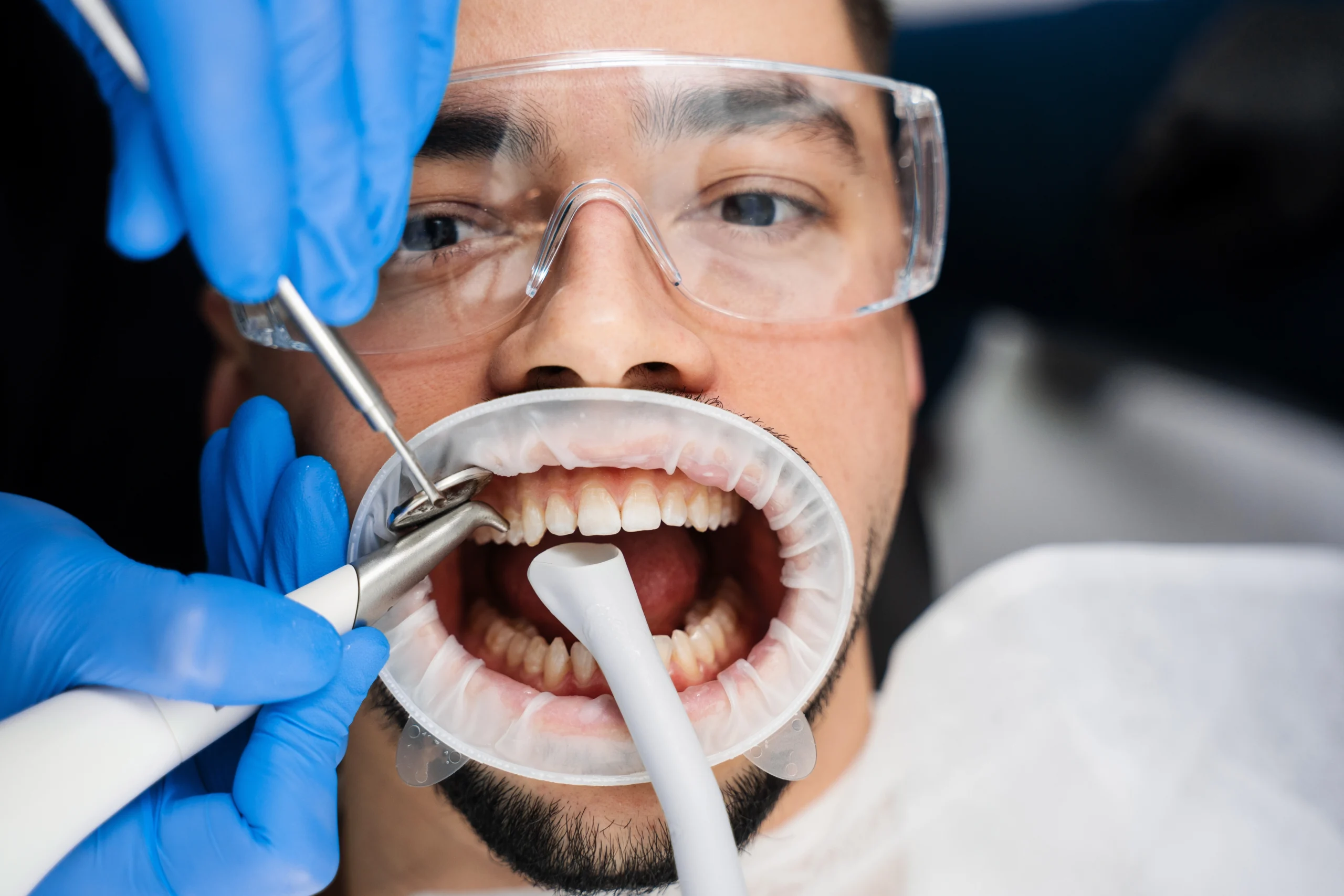 The clean itself at Lye Dental