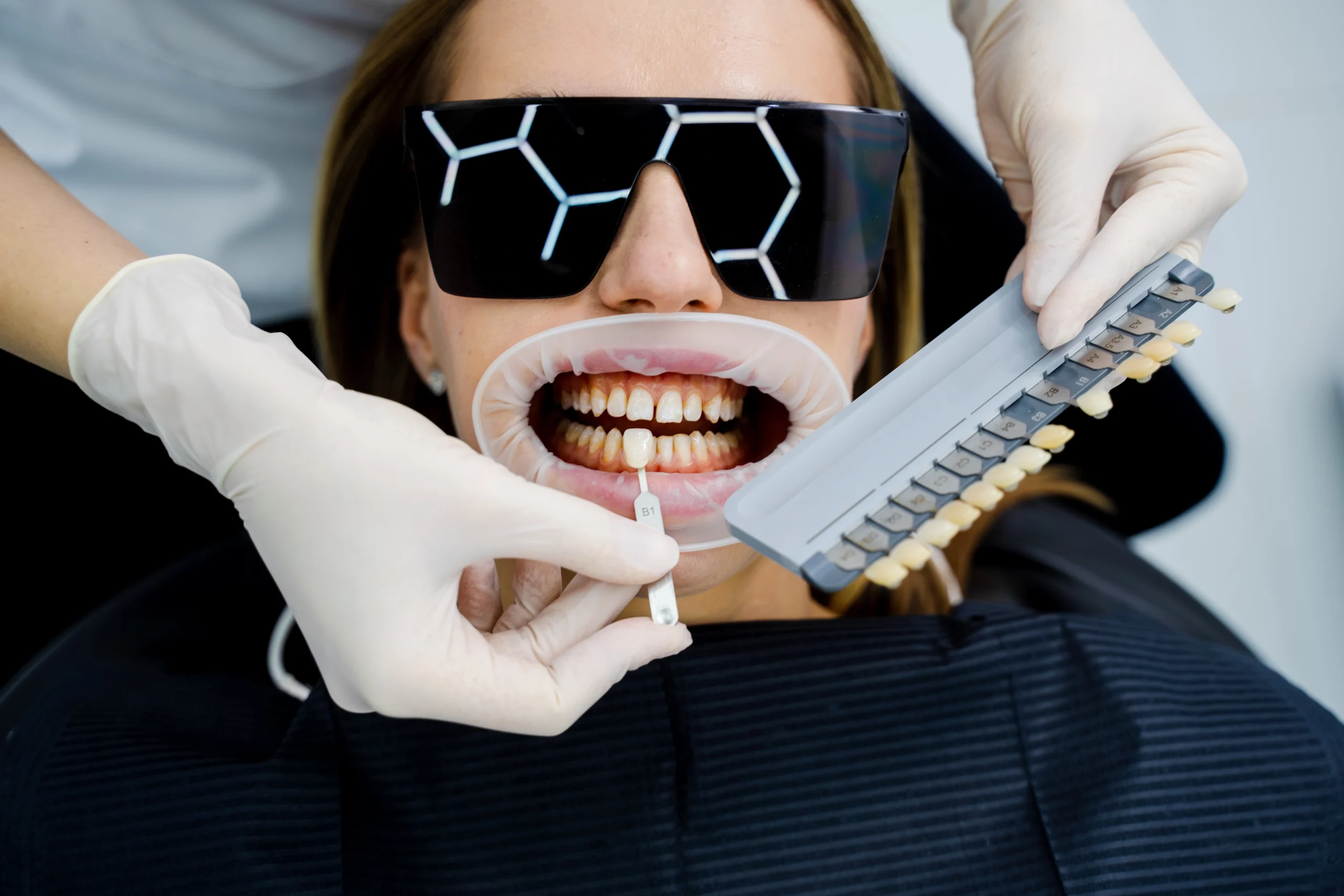 Teeth whitening at Lye Dental in Stourbridge