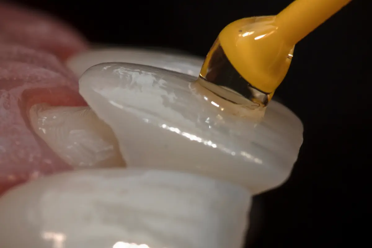 Veneers at Lye Dental and Implant Centre