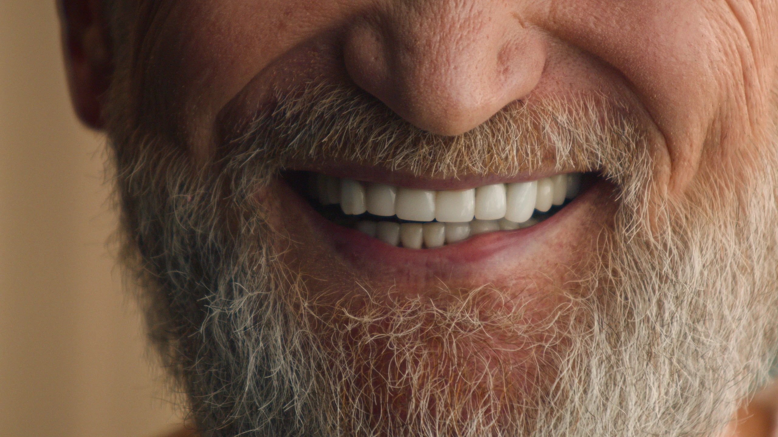 Dentures at Lye Dental in Stourbridge