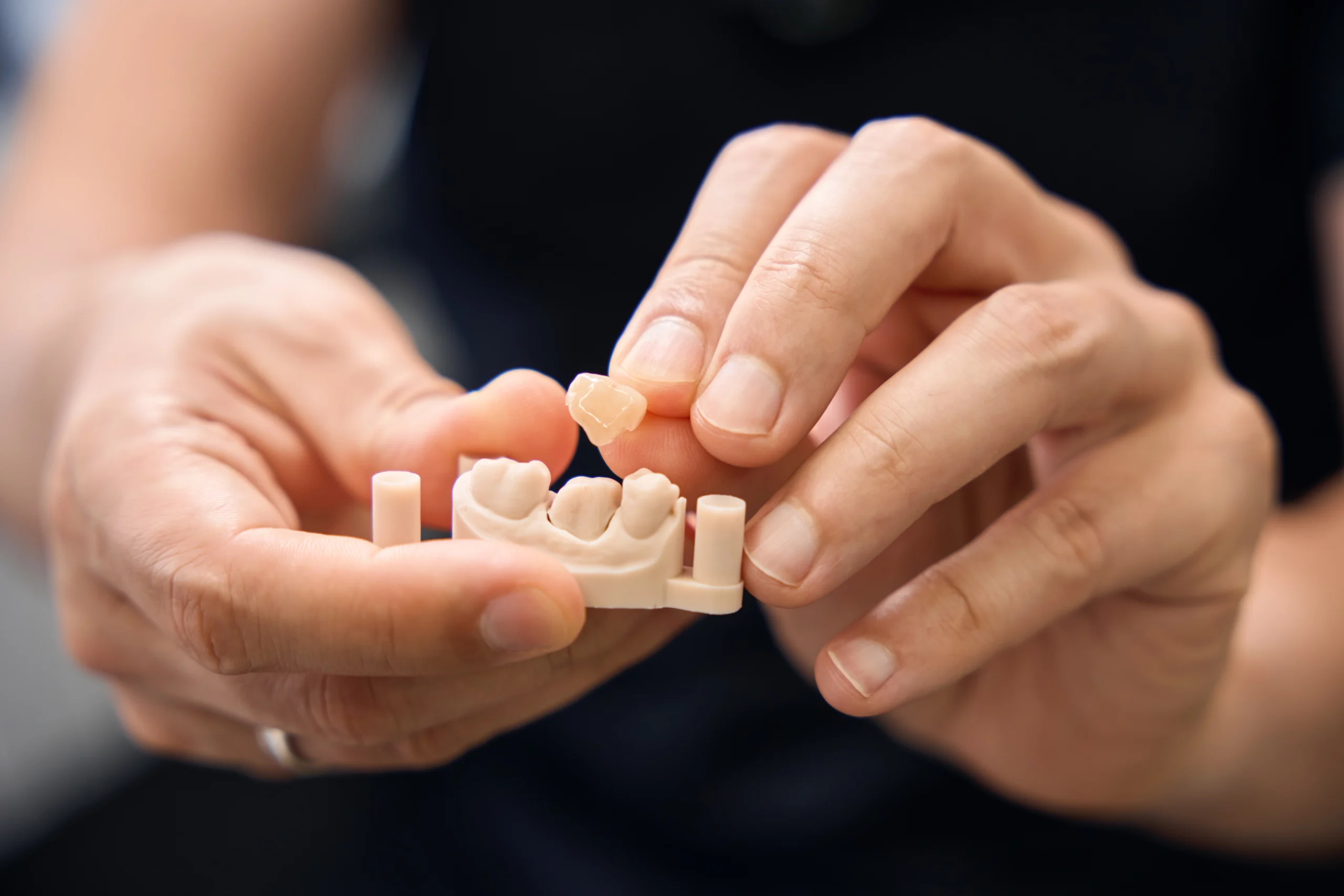 Dental crowns at Lye Dental and Implant Centre