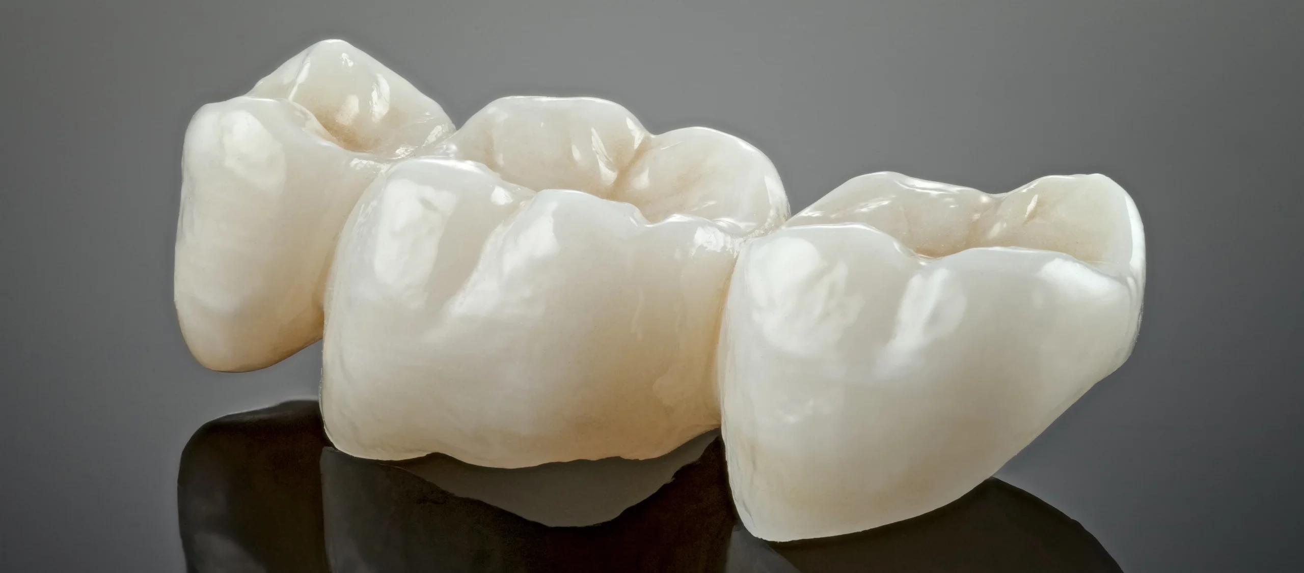 Dental bridges at Lye Dental and Implant Centre