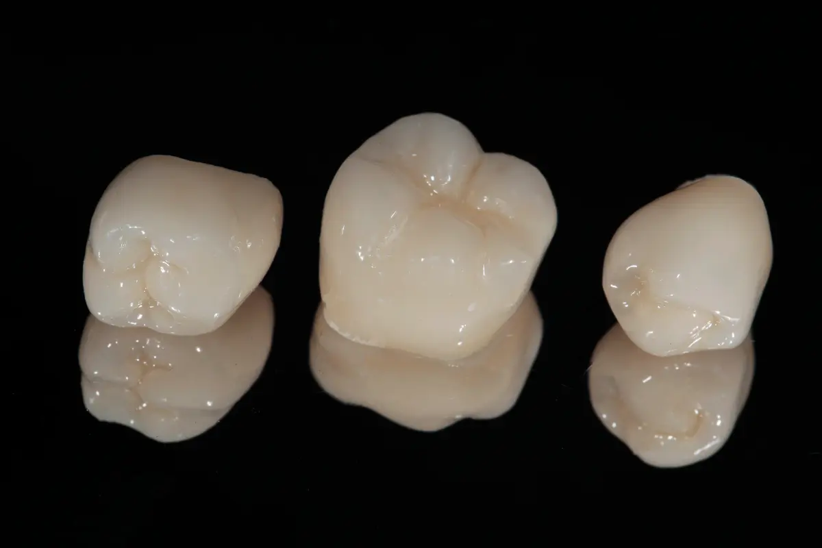 The lab makes your crown, at Lye Dental