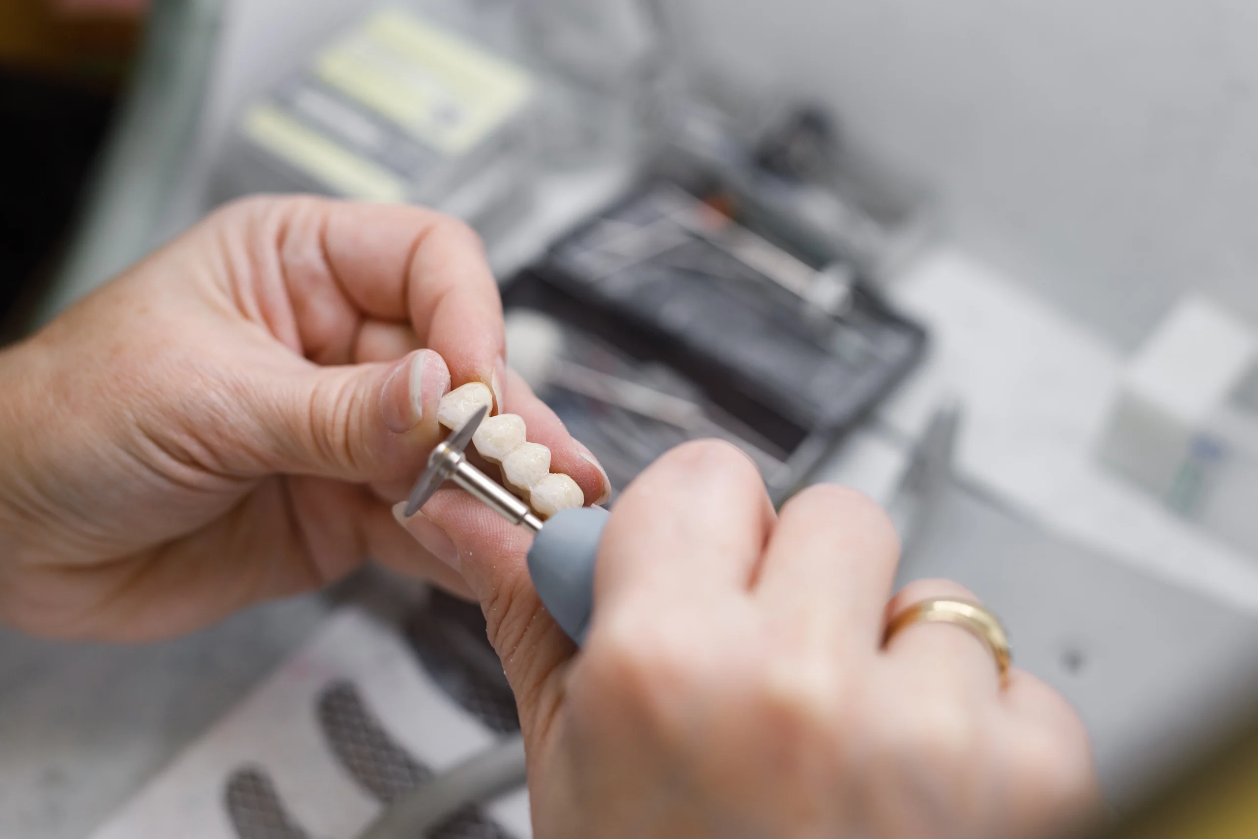 The lab makes your bridge, at Lye Dental