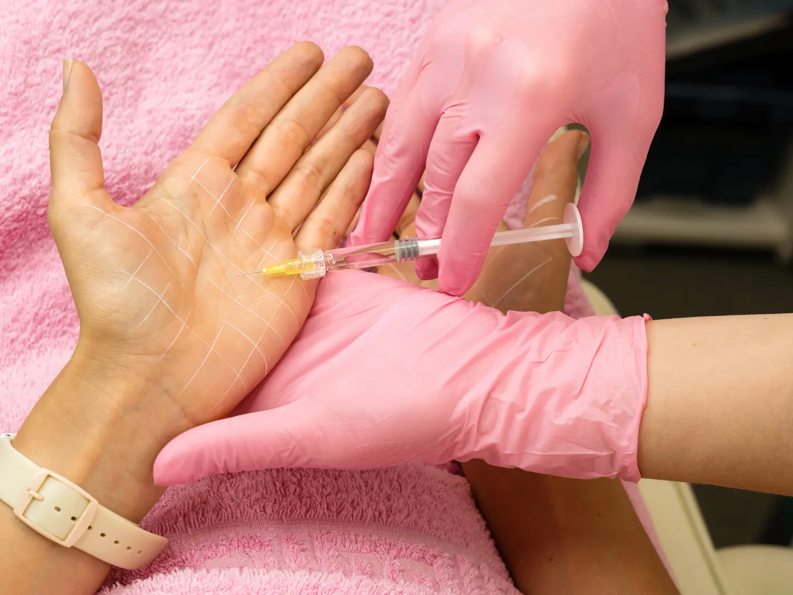 Treatment for excessive sweating at Lye Dental and Implant Centre