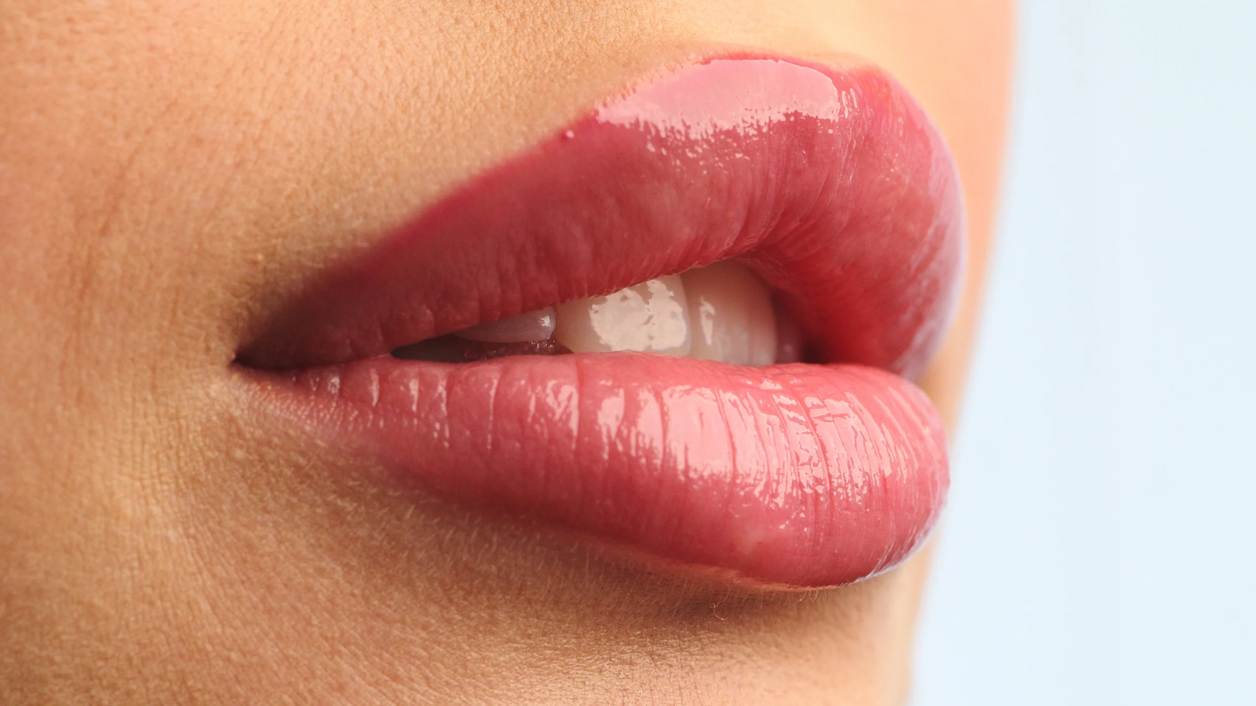 Lip fillers at Lye Dental in Stourbridge
