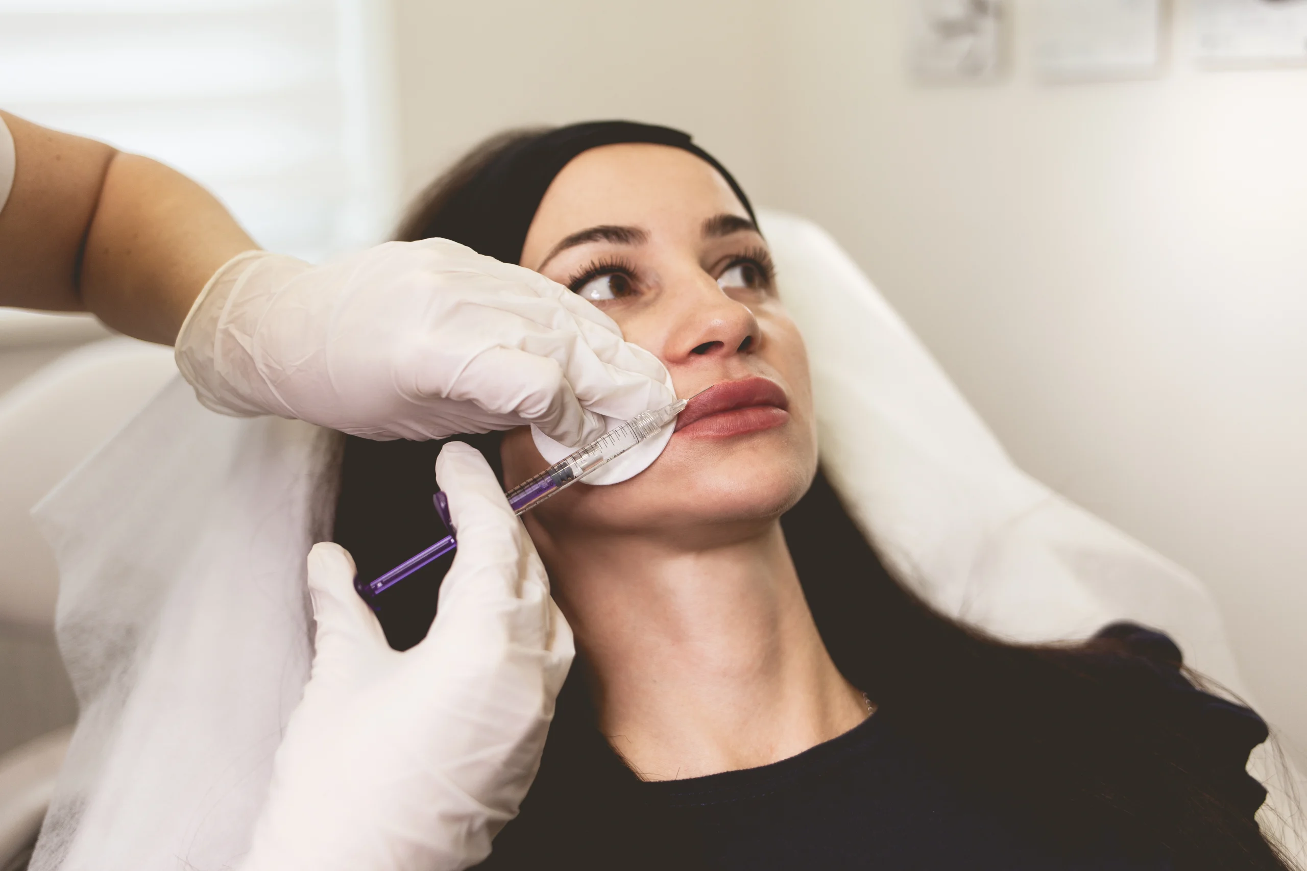 Lip fillers at Lye Dental